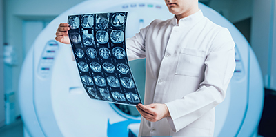 種植頭髮：解決脫發問題的有效方法