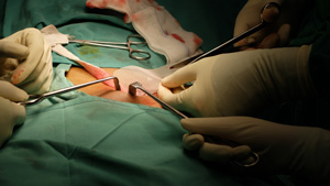 植眉係永久嘅嗎？專家爲你解答